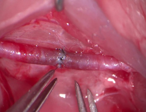 Μικροχειρουργική αποκατάσταση περιφερικών νεύρων