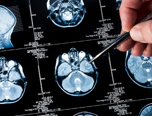 Οι τεχνολογικές εξελίξεις στη νευροχειρουργική