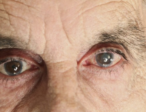 Οφθαλμικός καταρράκτης: Η συχνότερη αντιμετωπίσιμη πάθηση ματιών