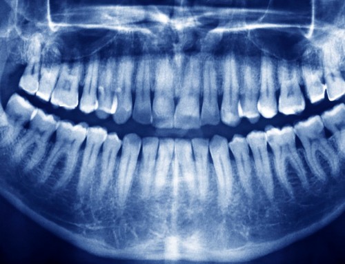 Κακή σύγκλειση των δοντιών και στοματική υγεία