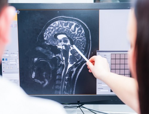 Οι αρνητικές επιπτώσεις της νόσου Graves στις περιοχές του εγκεφάλου