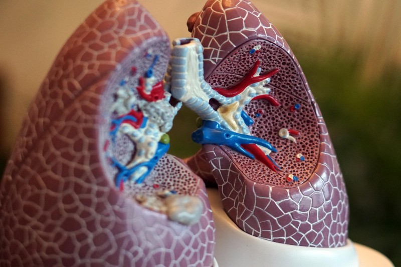 Βρογχικό άσθμα: Μια χρόνια φλεγμονή των αεραγωγών των πνευμόνων