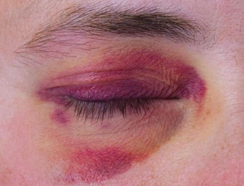 Κίνδυνοι τραυματισμού στο μάτι τη νύχτα της Πρωτοχρονιάς