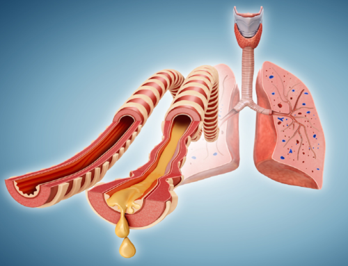 Οφέλη πνευμονικής αποκατάστασης χρόνιων αναπνευστικών παθήσεων