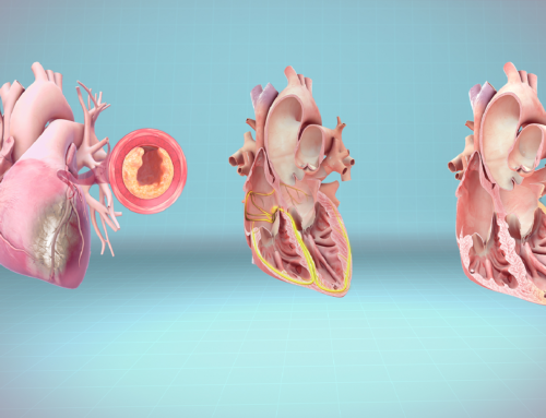 Έμφραγμα του μυοκαρδίου: Μία θανατηφόρα απειλή για την καρδιά